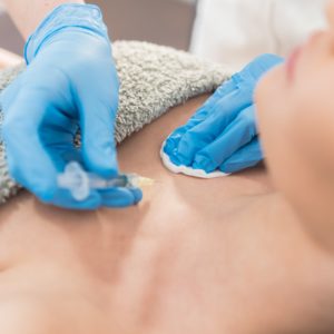 Micro-Needling Face/Neck/Chest 90 Minutes