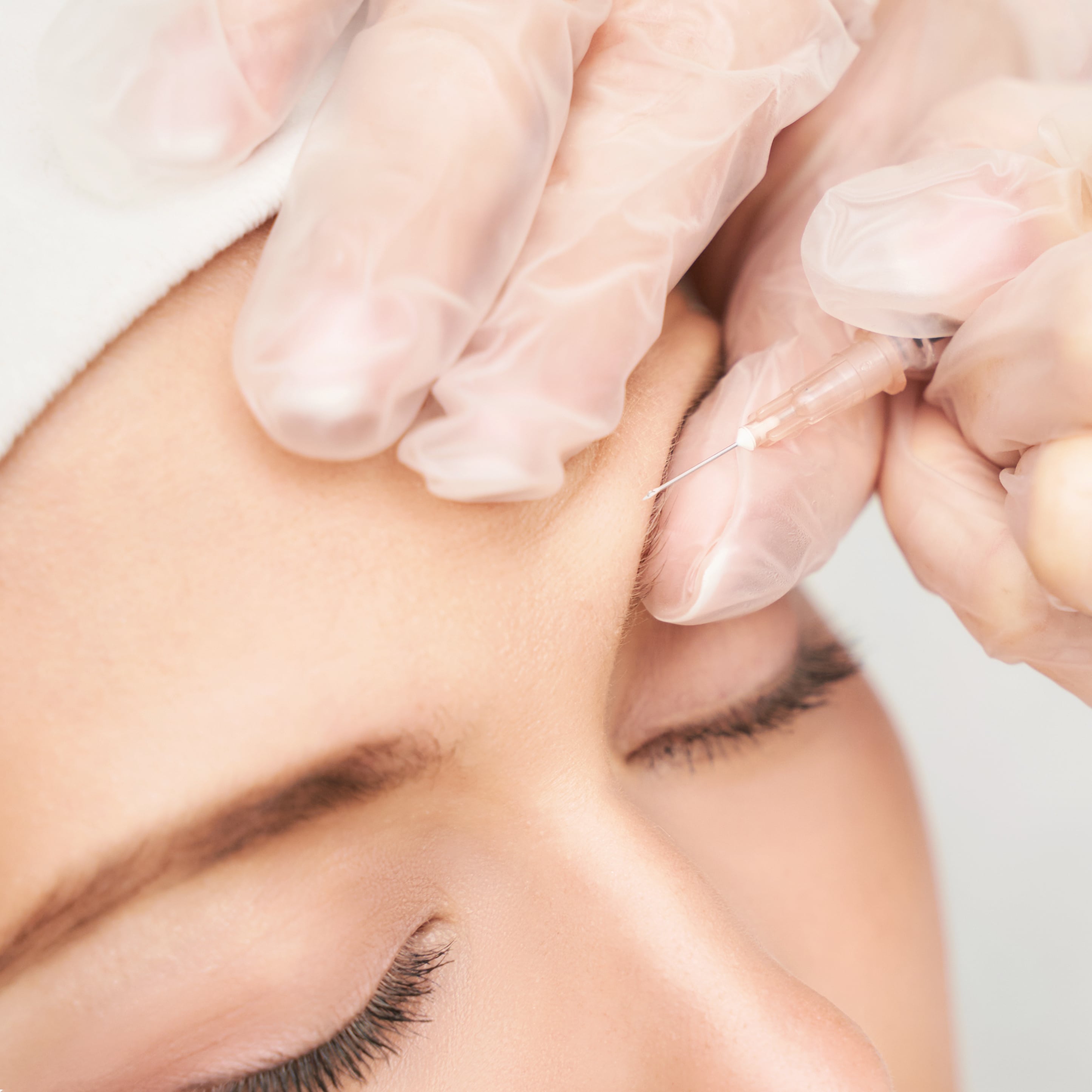 Micro-Needling Face Only 60 Minutes